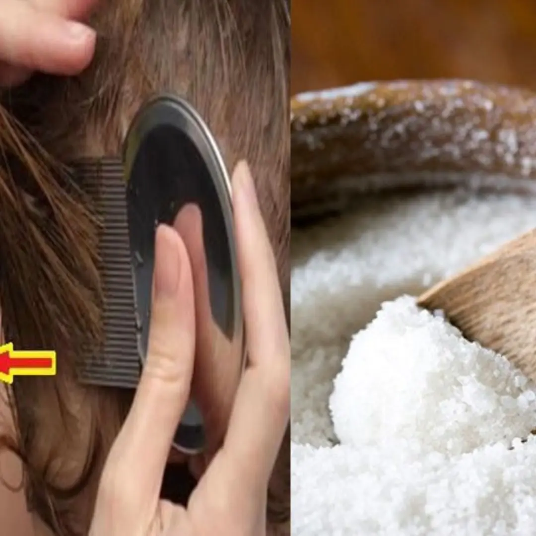 3 Most Effective Ways to Treat Lice with Salt at Home