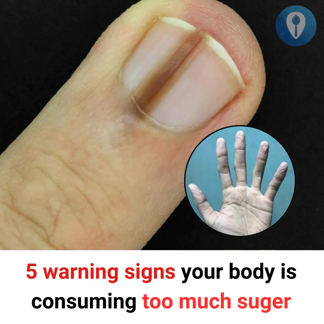 5 warning signs your body is consuming too much suger