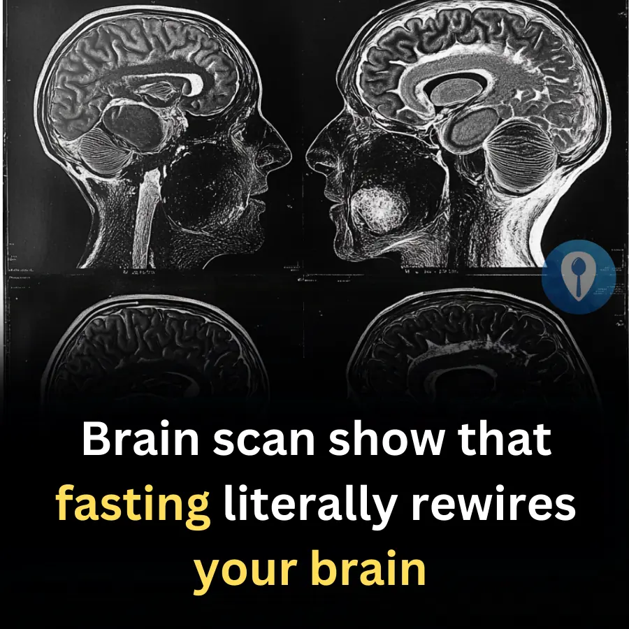 Brain scan show that fasting literally rewires your brain