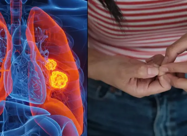 Simple 'finger test' at home can detect early signs of lung c.a.n.c.e.r