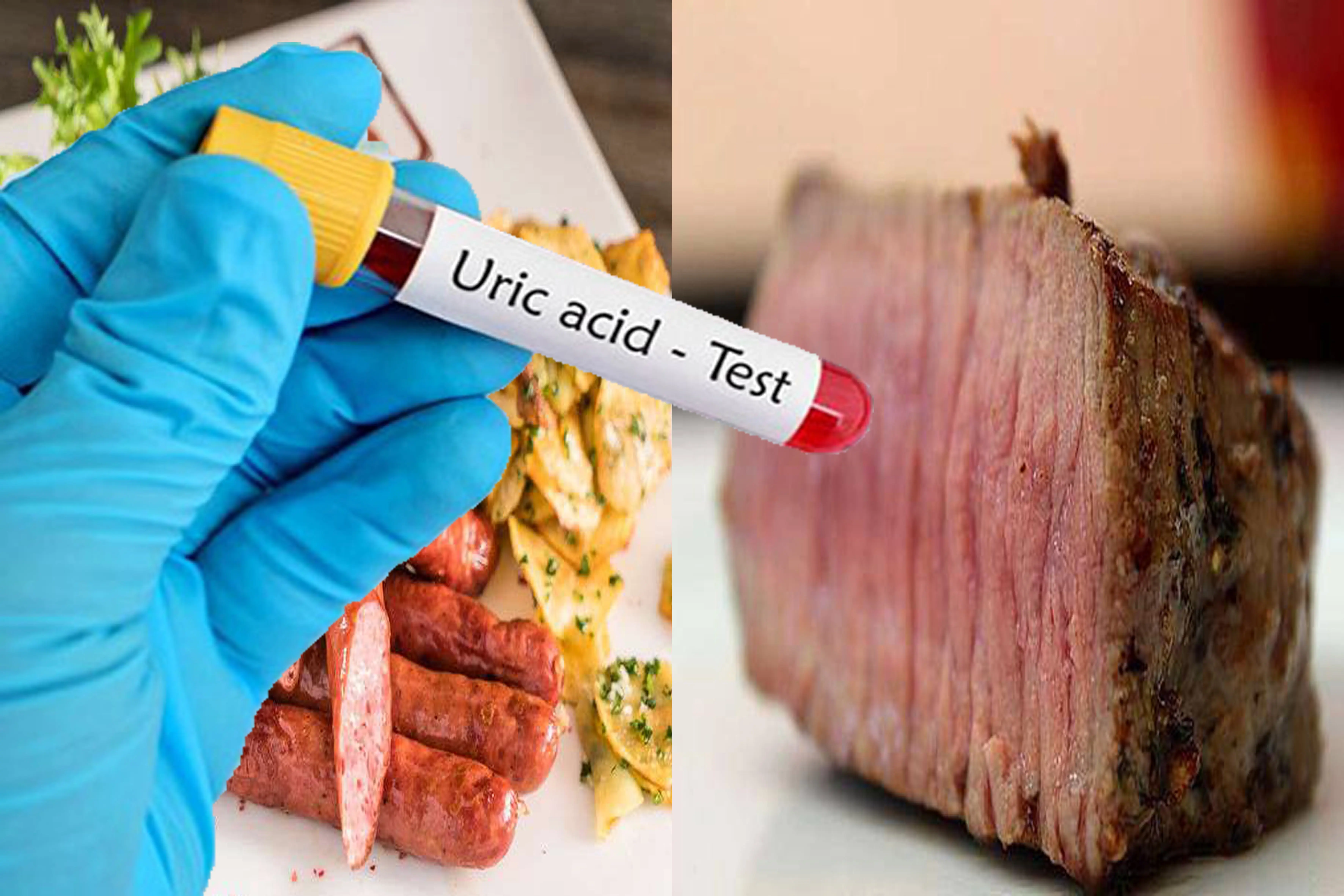 Can You Eat Meat If You Have High Uric Acid? 3 Types of Meat That Are Safe and How to Consume Them Wisely