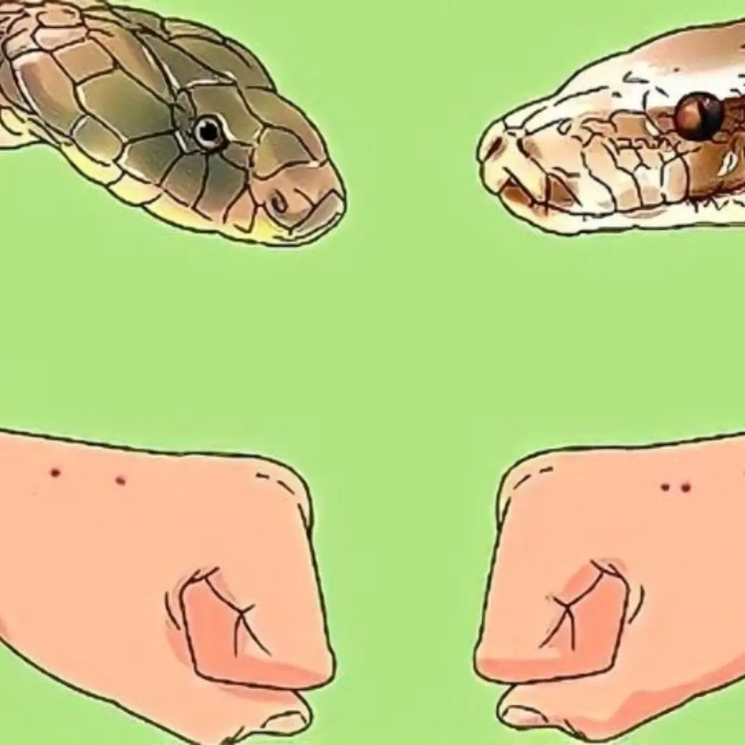 When bitten by a snake, you should do these things first