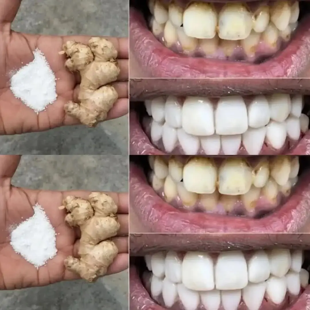 Whiten Your Teeth in Just 2 Minutes – Powerful Home Remedy with Ginger & Salt