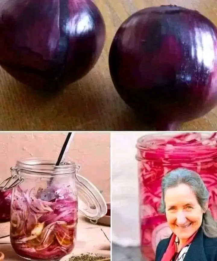 How to Use Red Onion for Varicose Veins: You'll be amazed, I promise