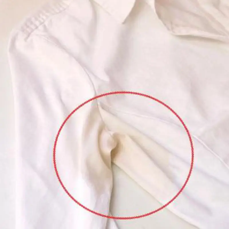 Don’t throw away your yellowed white shirts