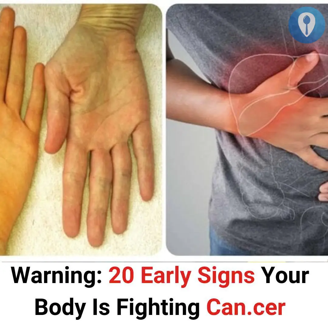 Warning: 20 Early Signs Your Body Is Fighting Can.cer