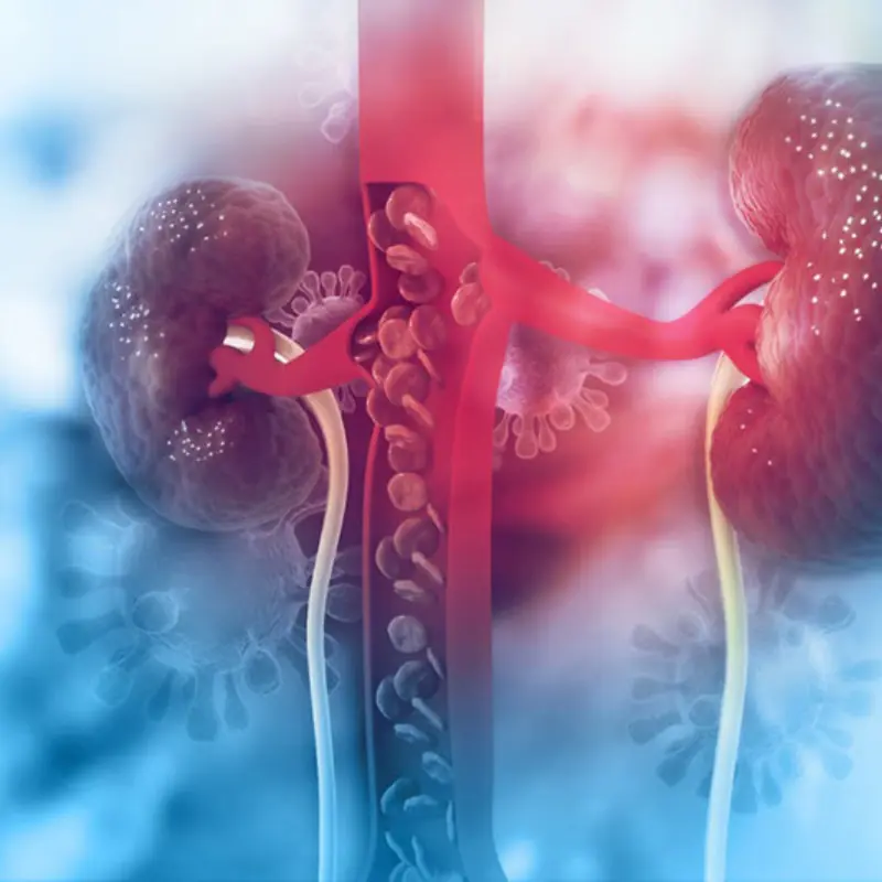 8 signs of kidney failure that if ignored may require lifelong dialysis