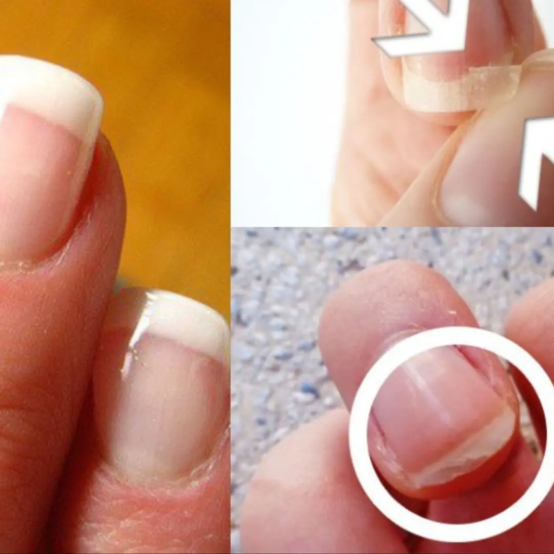 Check out these 7 signs of your nails to know your current health status