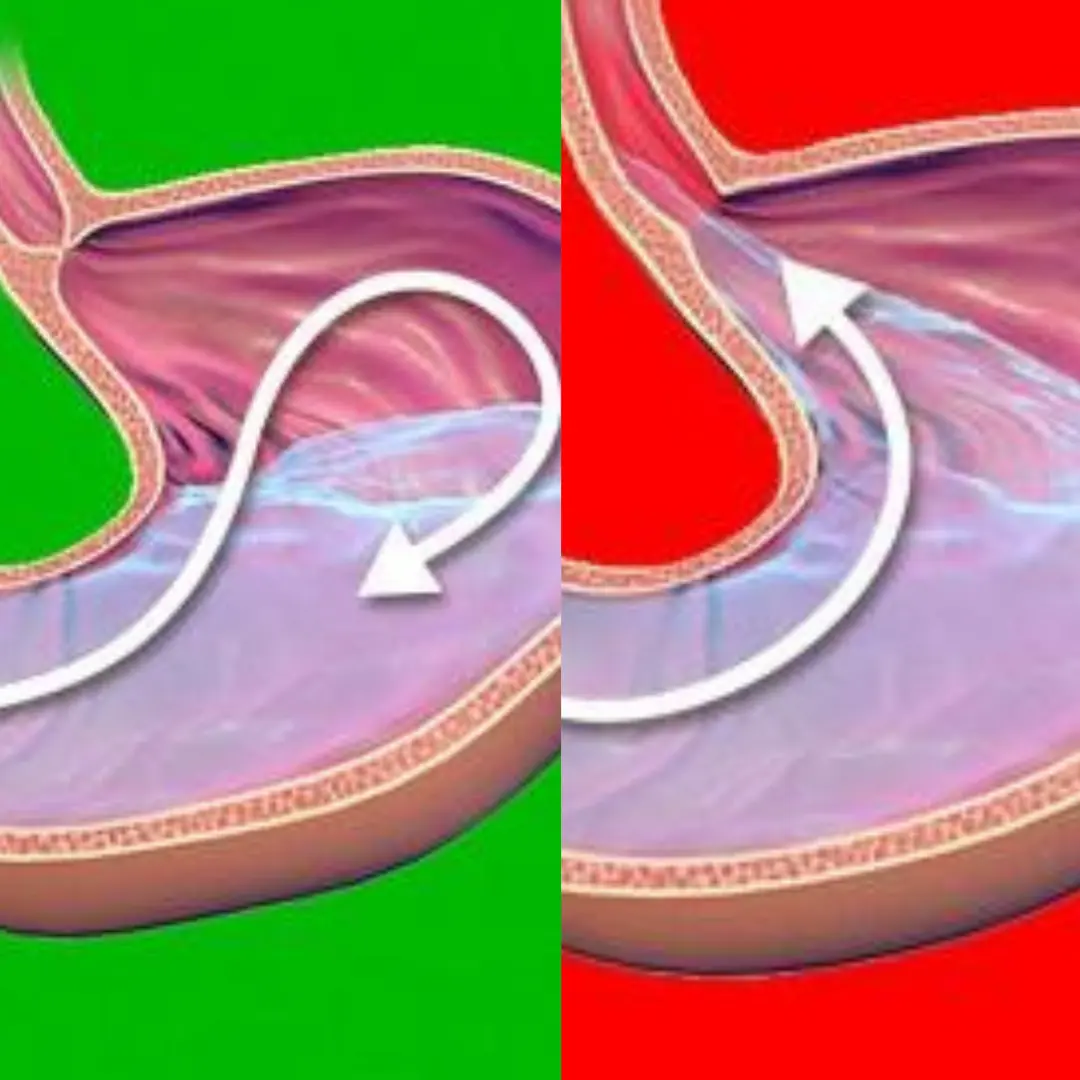 When sleeping, is it better to lie on the left or right side? The two positions actually have a big difference that has a significant impact on health.