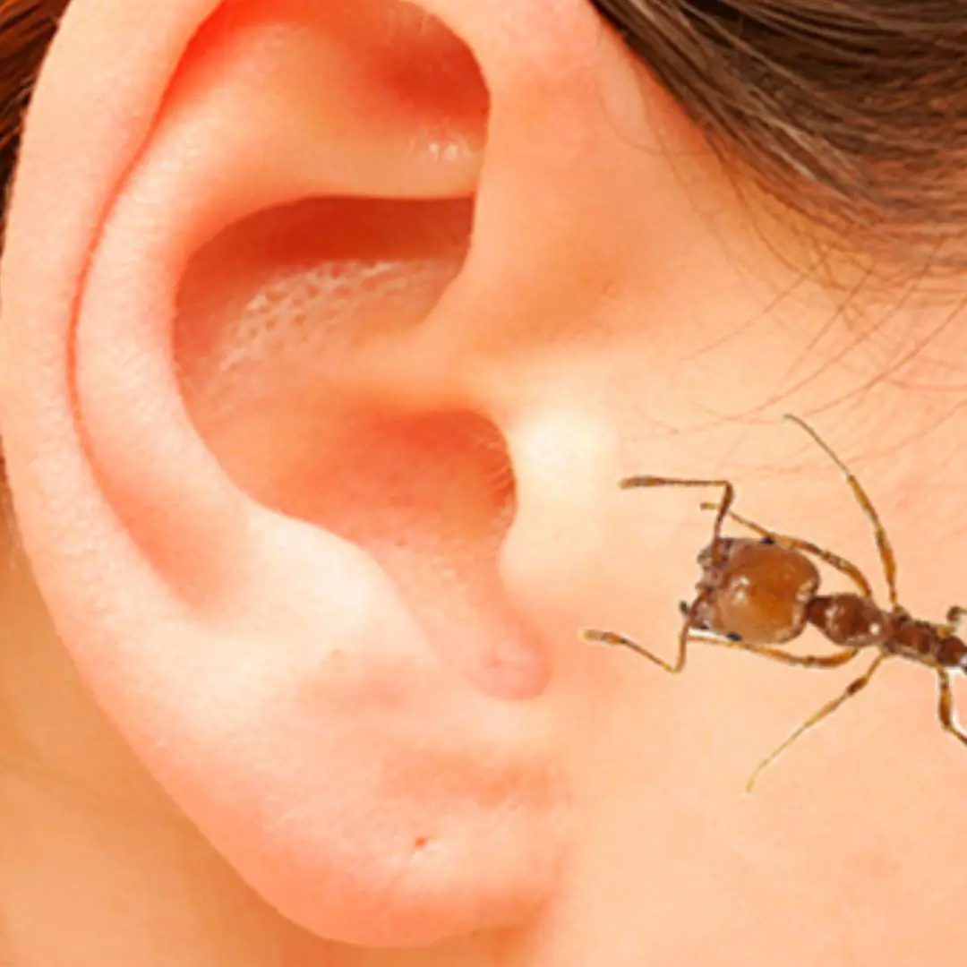 How to treat ants in the ear safely and effectively