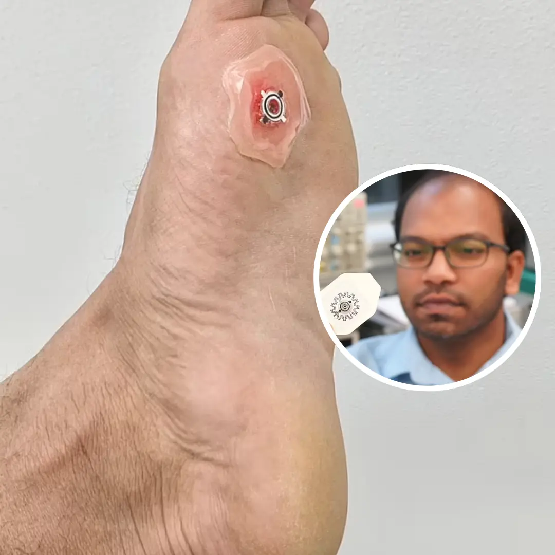 The band-aid of the future: Smart bandage heals injuries 30% faster than standard dressings by producing an electric field around the wound