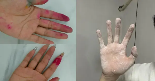A Sincere Warning: Always Wear Gloves When Doing These 7 Things—Or Risk Har.ming Your Health