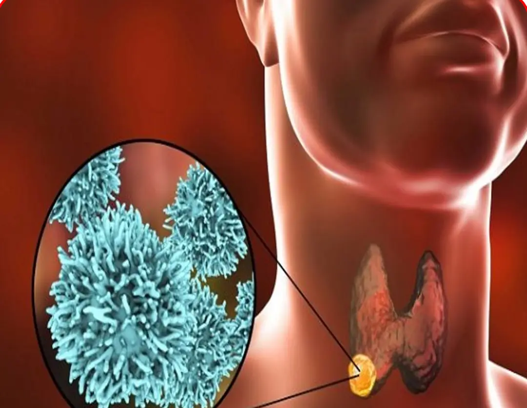 8 foods that are incompatible with tumors, remind each other to eat them regularly