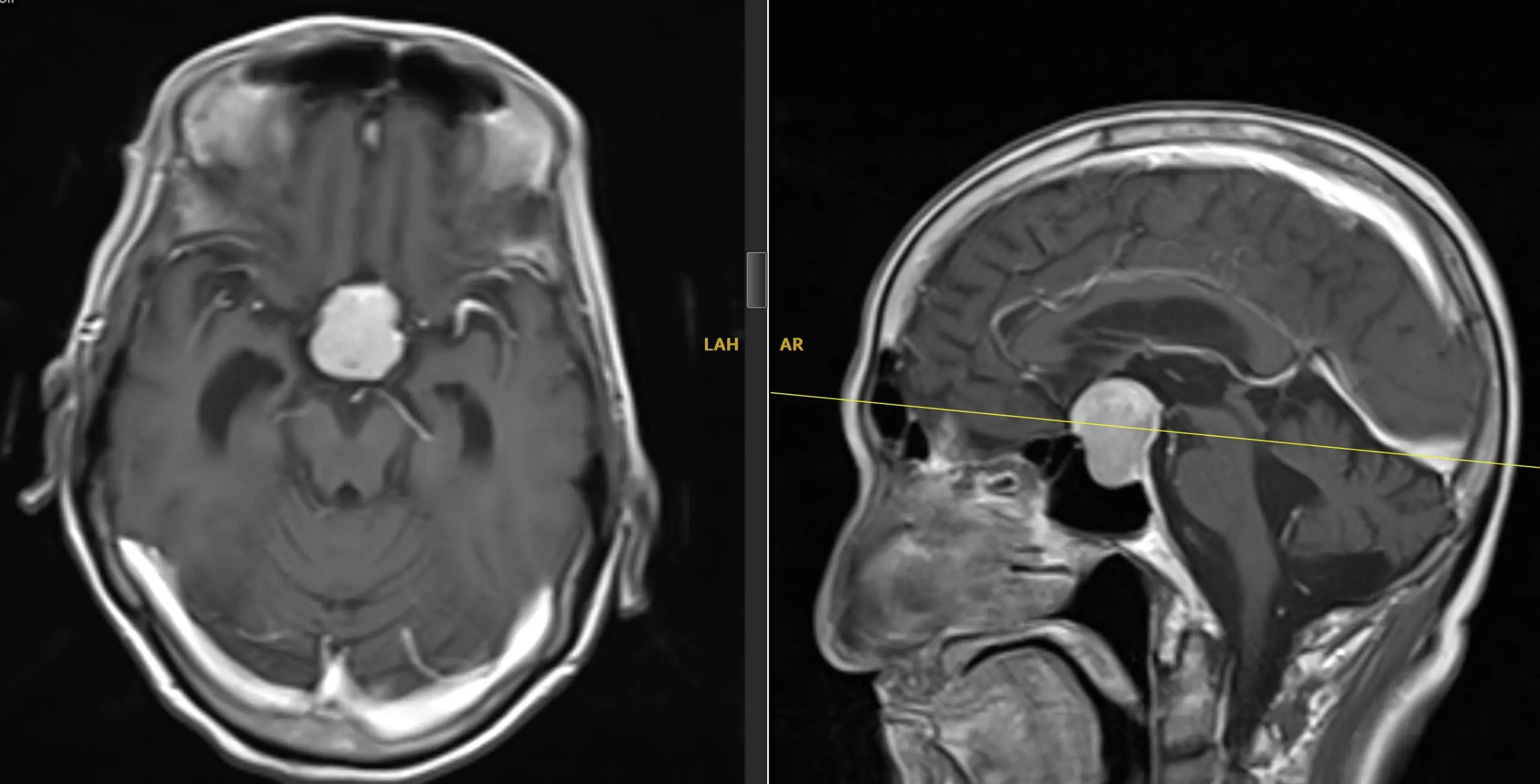 Doctors warn of many cases of blurred vision and headaches of unknown cause
