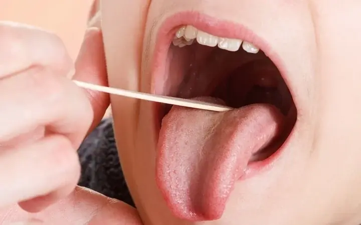 Mouth ulcers that did not heal for three months, went to the hospital for examination and discovered can:cer