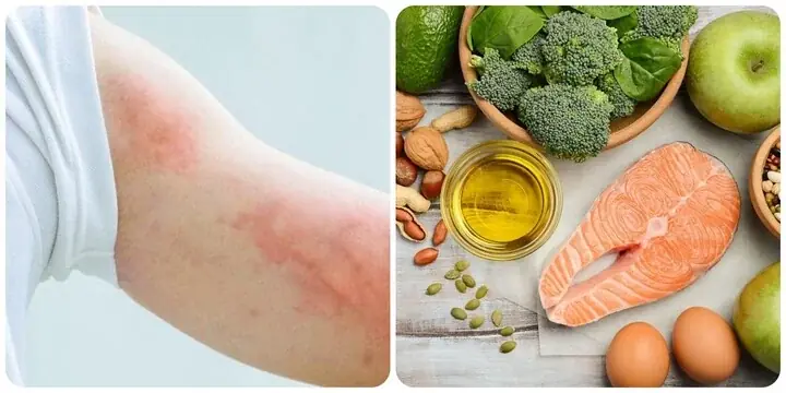 Signs of Omega-3 deficiency you should not ignore