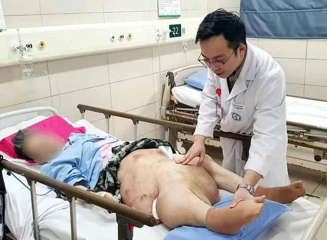 Ignoring tumor treatment, woman completely paralyzed, many body parts deformed