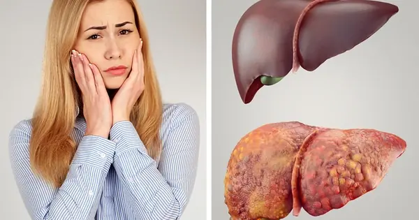 7 signs that your body has accumulated too many toxins. If you don't detoxify quickly, all kinds of diseases will break out