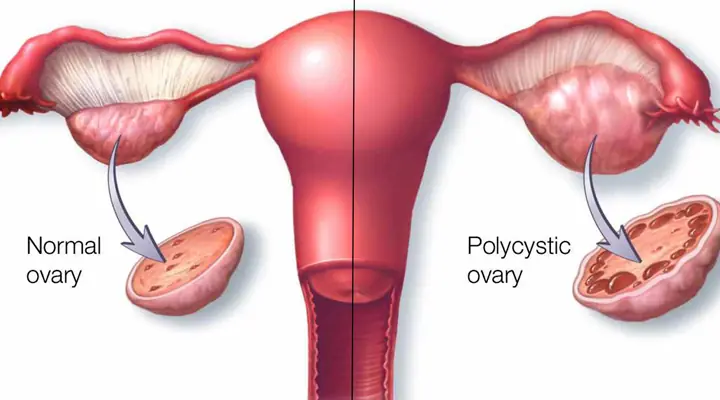Eat 6 things to help women detoxify their ovaries and prevent gynecological diseases