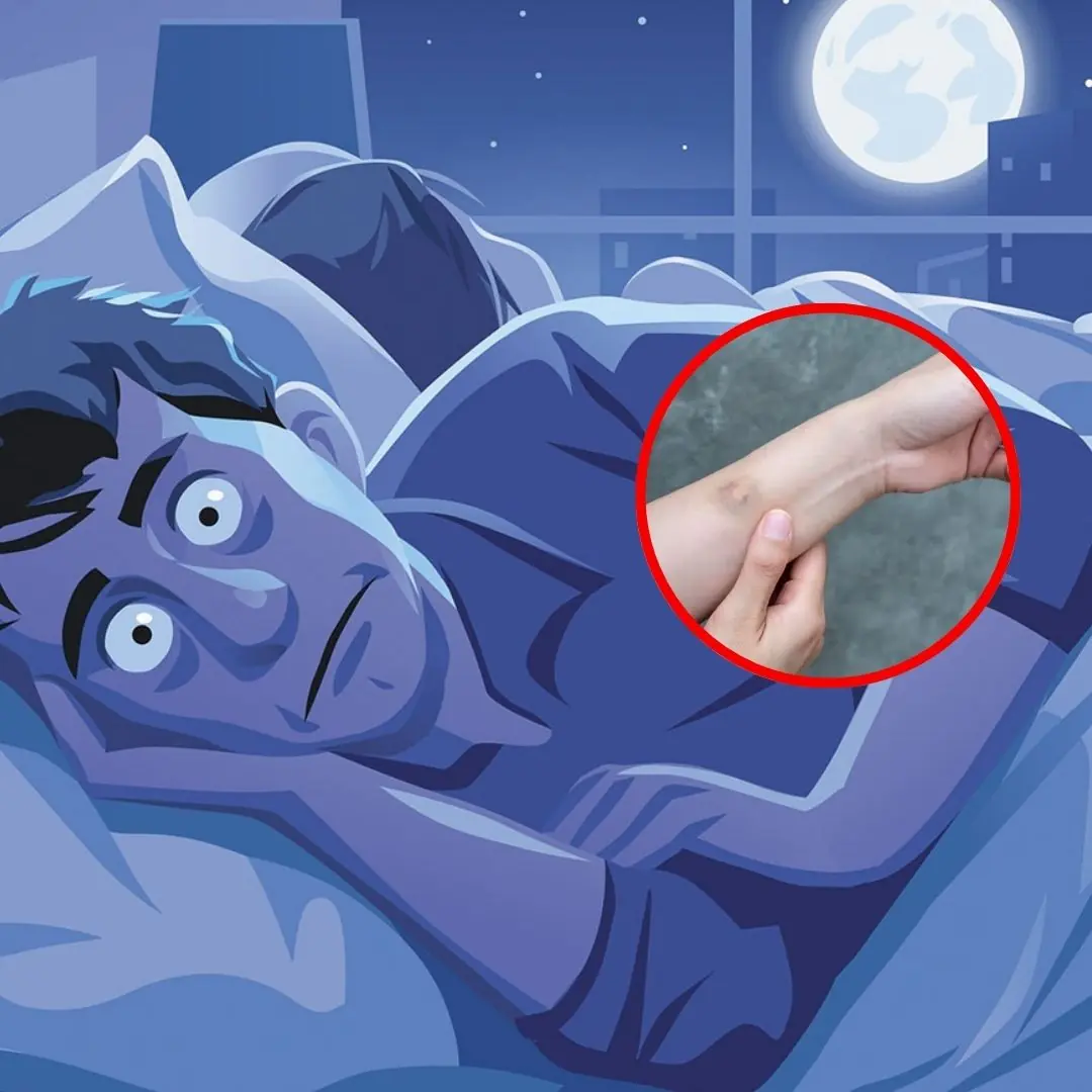 Have you ever wondered why when you wake up, mysterious bruises appear on your body?