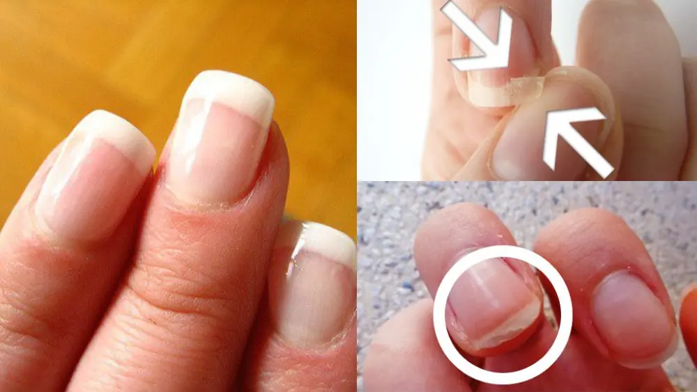 Look at your nails to detect health problems