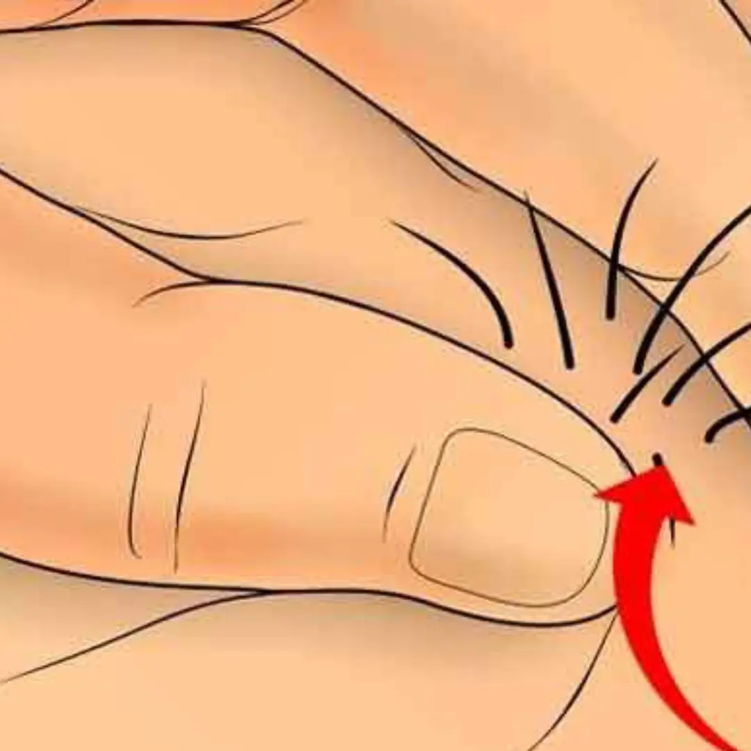 Is it okay to have hair growing in the a.n.us? Experts explain.