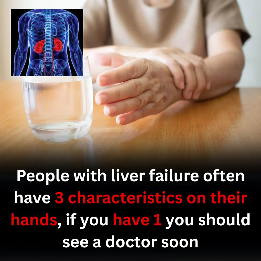 People with liver failure often have 3 characteristics on their hands, if you have 1 you should see a doctor soon