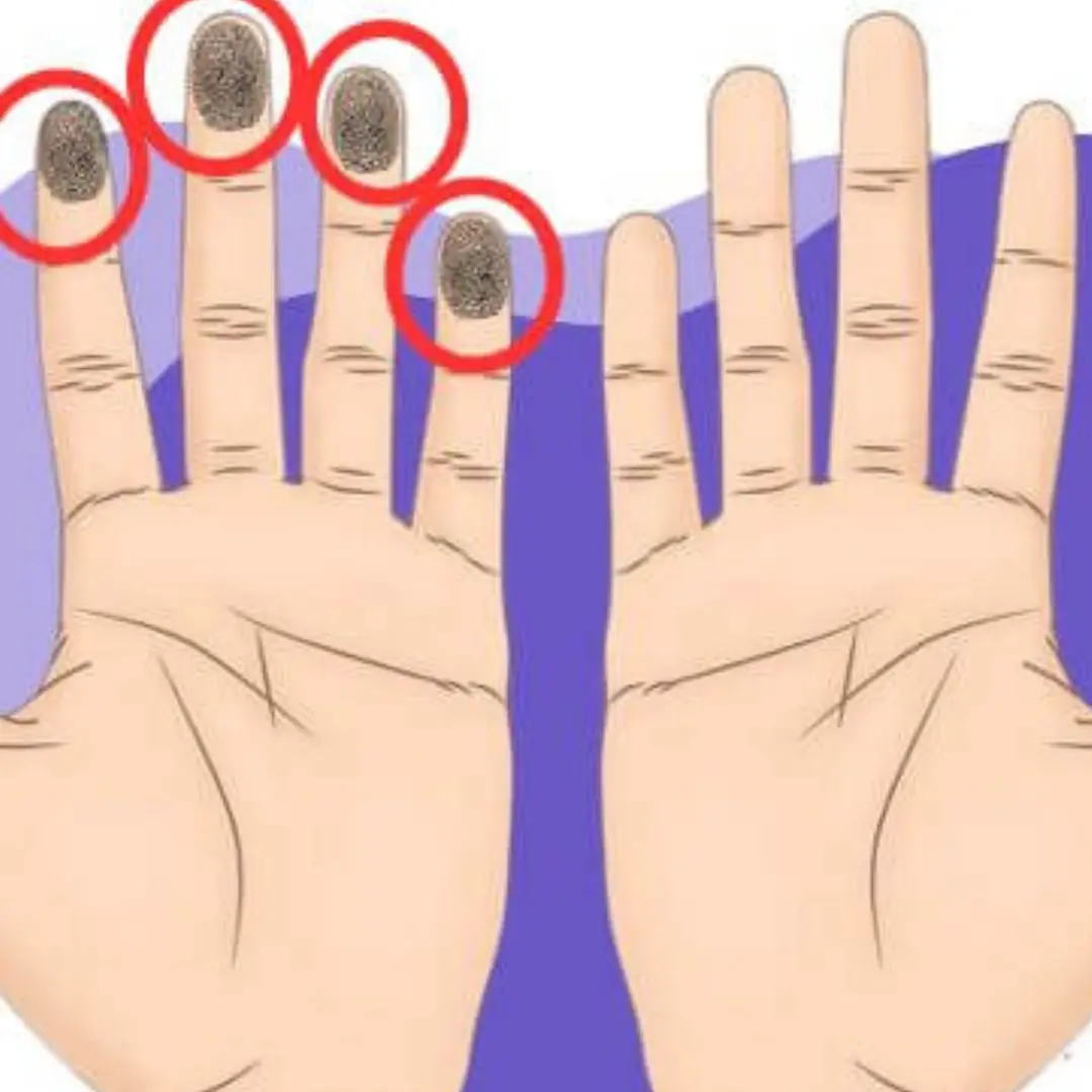 How many fingertip whorls do you have? The number of whorls you have could reveal secrets about your future