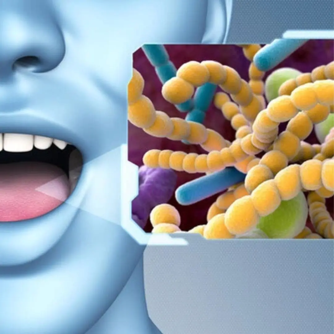 Should you brush your teeth before or after breakfast