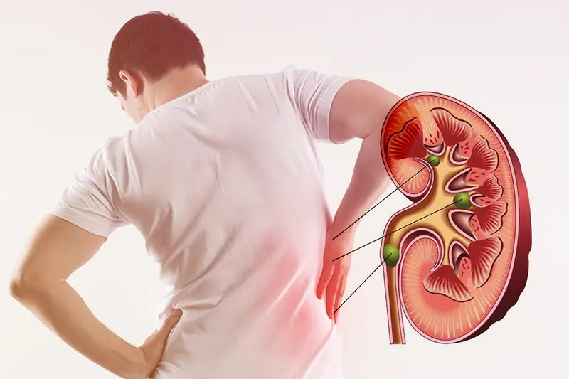 8 symptoms of kidney fai.lure you should never ignore