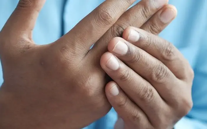 4 changes in fingers that could be signs of lung can.cer