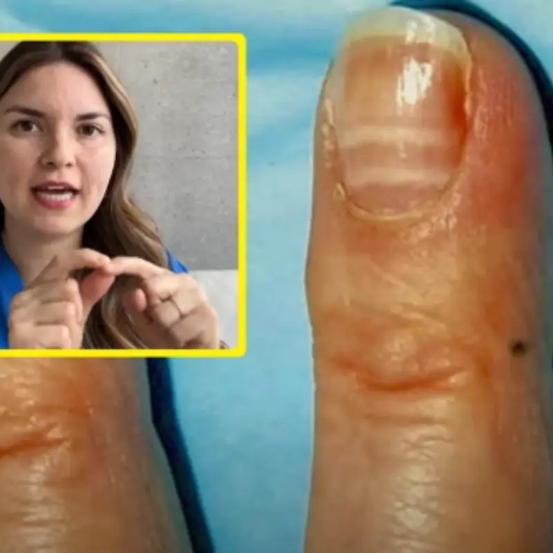 10 Visible Signs of Liver Damage You Can Spot with the Naked Eye