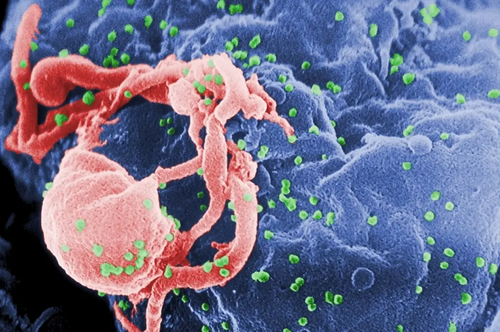 Potential way to cure HIV permanently found