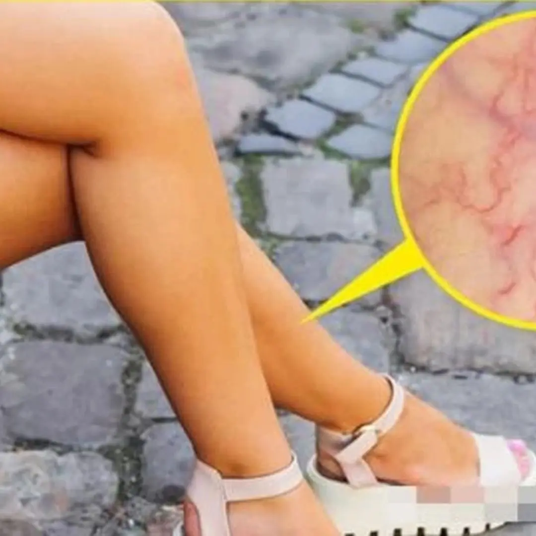Why should women not sit with their legs crossed?
