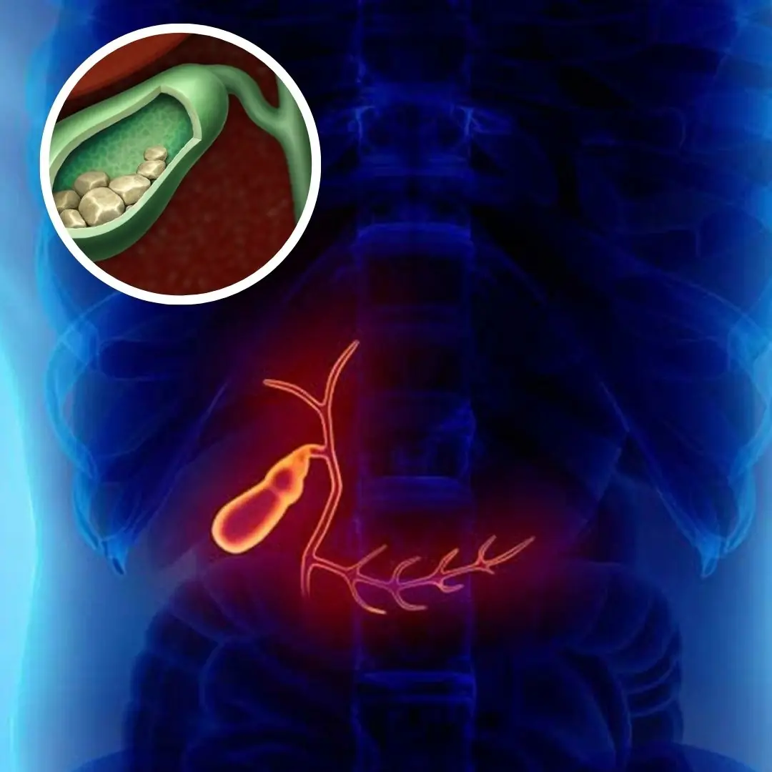 6 silent symptoms warning of gallbladder c.a.ncer