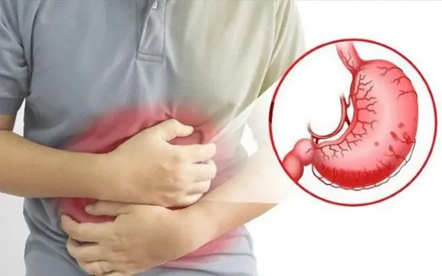 8 wa.rning signs your stomach dis.ease may have reached a severe stage
