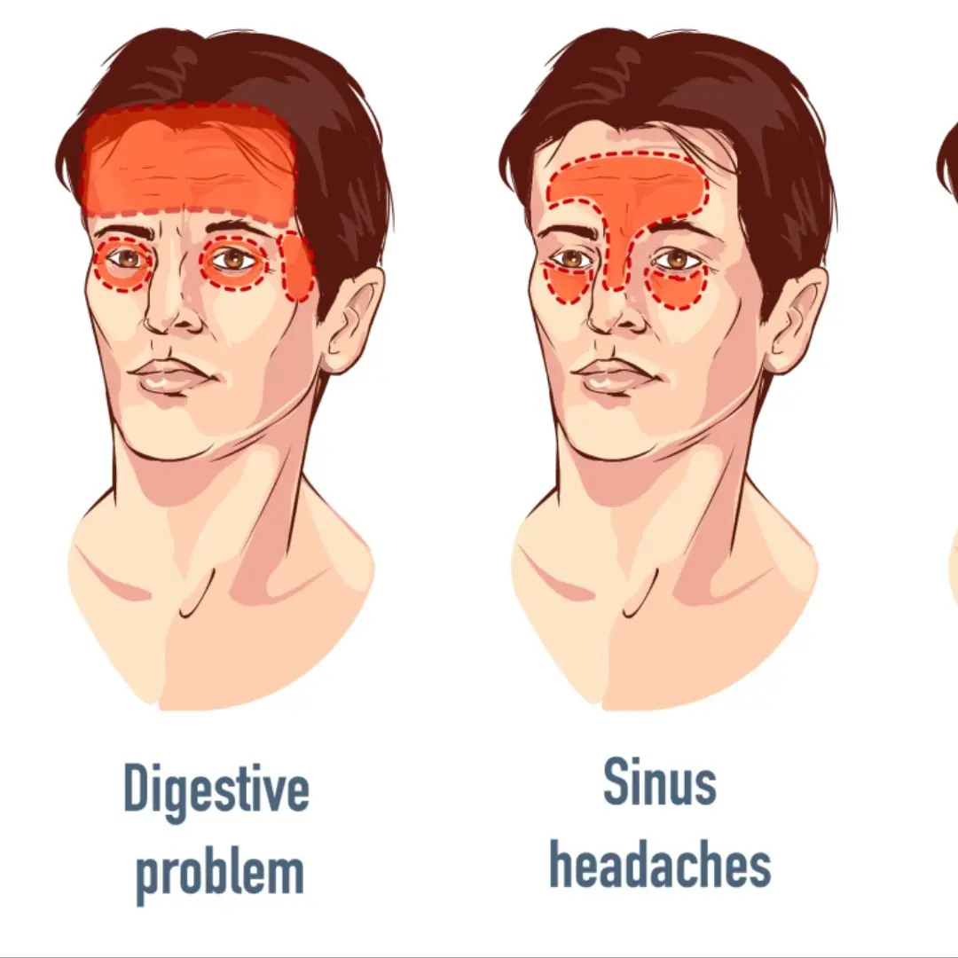 3 Warning Signs of Severe Headache that Might Save You from Cerebrovascular Disease