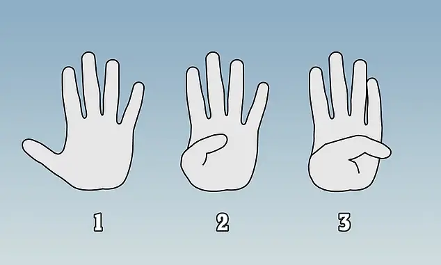 Doctor reveals simple thumb test that can detect heart problems like 'ticking time bomb'