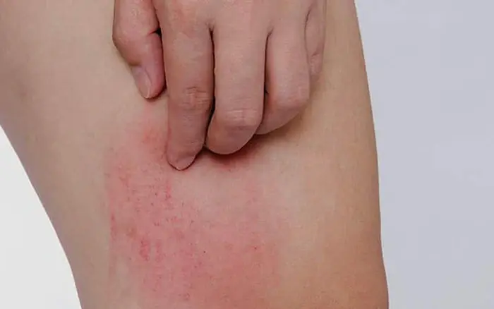 Two it.chy body parts may signal liver can.cer