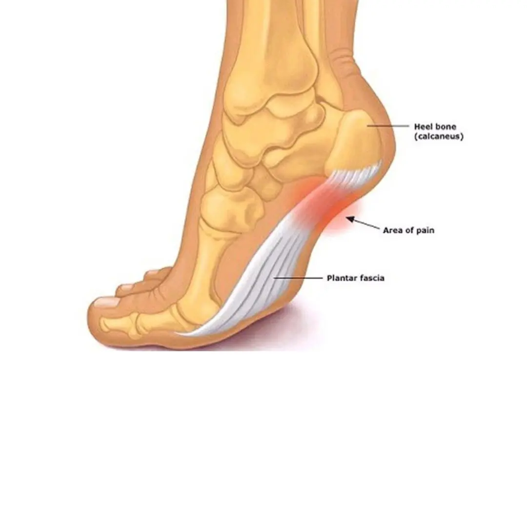 What is the disease that causes frequent numbness in the legs? What is the cause?