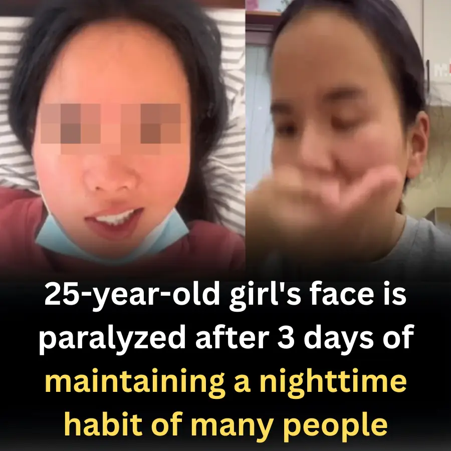 25-year-old girl's face is paralyzed after 3 days of maintaining a nighttime habit of many people