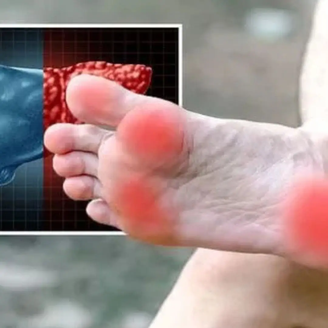 Fatty liver disease: The sign in your feet that means the condition is irreversible