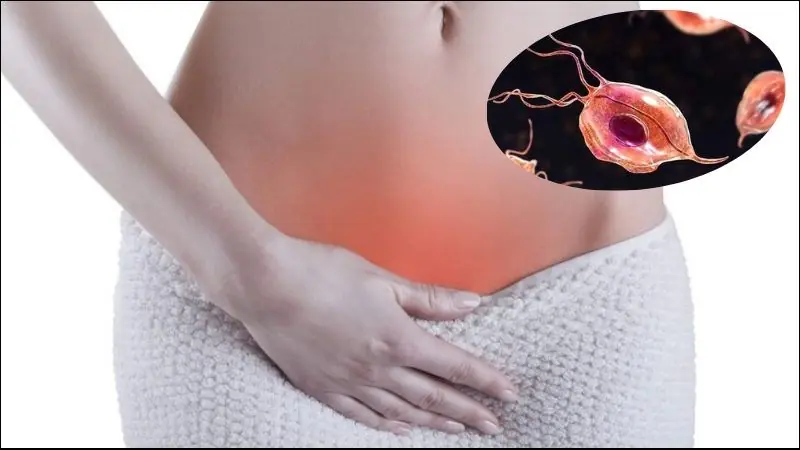 Why Does the Vagina Smell Sour? 4 Real Reasons Every Woman Should Know