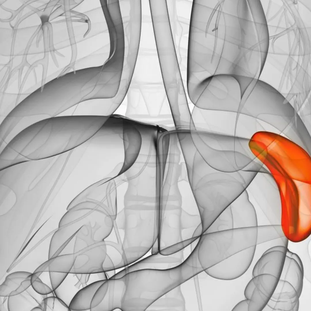 What are the symptoms of ca.n.cer of the spleen?