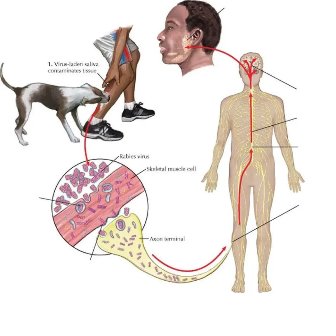 Recognize signs of rabies according to each stage of the disease