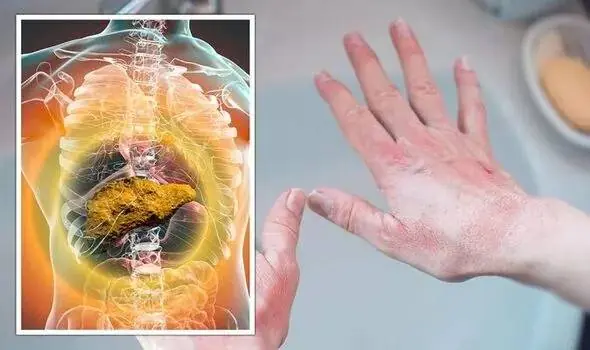 When Your Li.ver Is “Drenched” in Fat, Your Body Sends 5 Nighttime Warnings