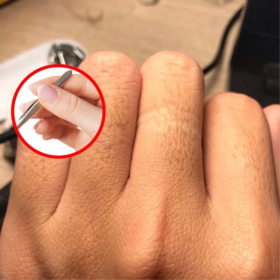 Why do women grow a lot of hair on their fingers?
