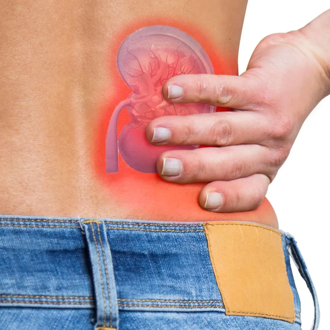 4 Healing Drinks to Prevent and Dissolve Kidney Stones