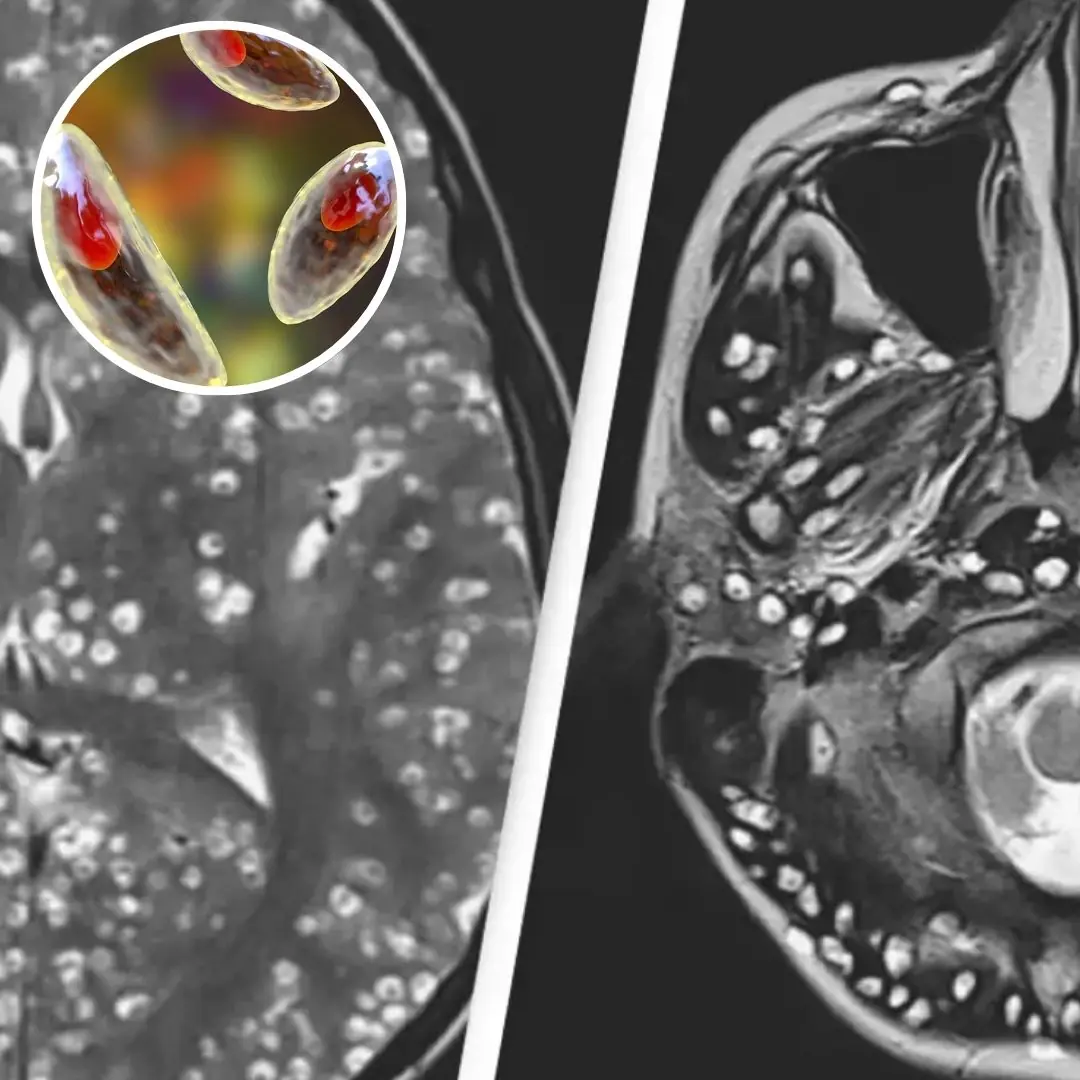 Te.r.r.ifyi.ng study finds 30% of Americans could be infected with parasite that has ho.r.r.i.fic impact on brains