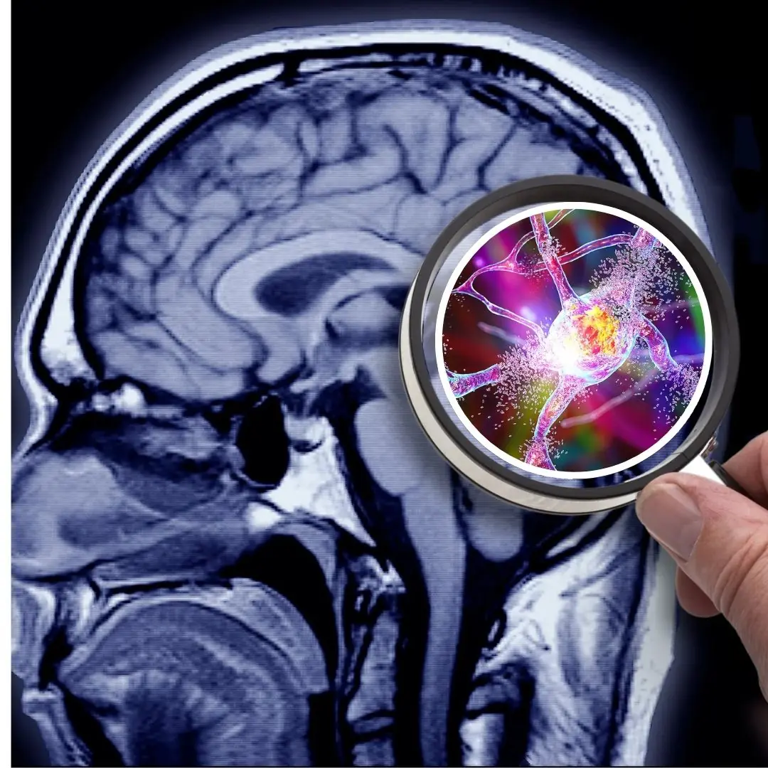 Alzheimer’s May Not Originate in the Brain, Scientists Suggest
